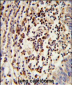 MOSC2 Antibody (C-term)
